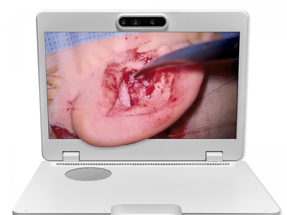 达擎之＂Heads-up 3D显微手术显示系统＂，整合4K裸眼3D显示及眼球追踪系统，具备快速追踪人眼移动位置功能，减轻医师长时间维持固定姿势的负担，让医师能有更宽广清晰的3D立体视野及更舒适的姿势来执行手术。